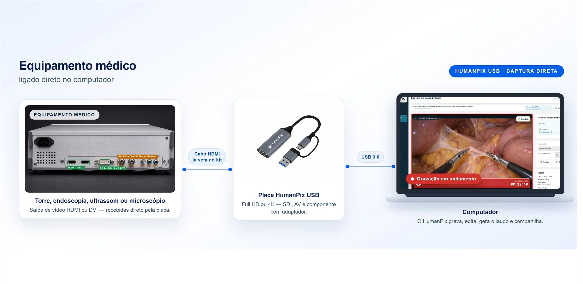 Ilustração da ligação: a saída HDMI da torre de vídeo entra na placa HumanPix USB, a placa entra no computador por USB 3.0 e o HumanPix grava o procedimento