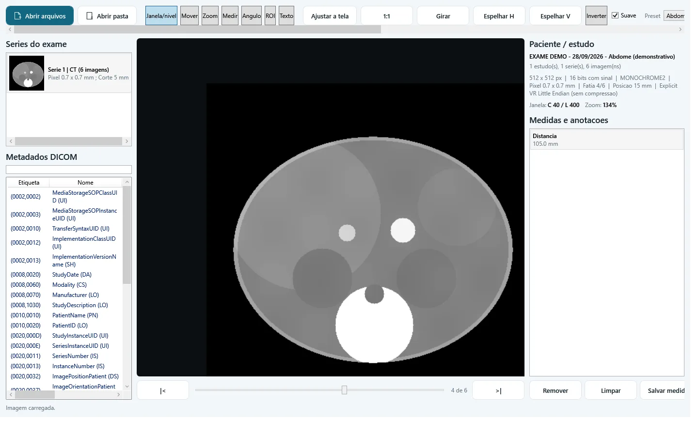 Visualizador DICOM do HumanPix com um exame demonstrativo: corte de tomografia com medida em mil&iacute;metros, a lista de s&eacute;ries e o painel de metadados