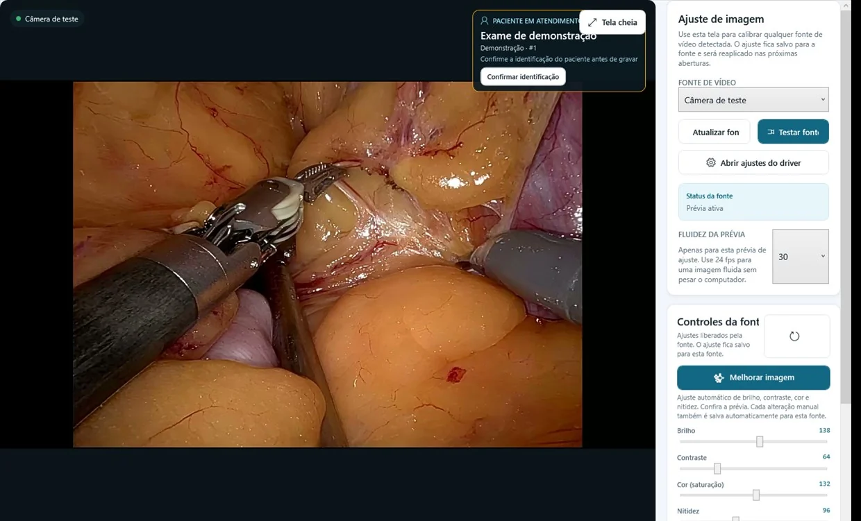 Tela de Ajuste de imagem do HumanPix com a pr&eacute;via da fonte de v&iacute;deo, o bot&atilde;o Melhorar imagem e os controles Brilho, Contraste, Cor e Nitidez liberados pela placa